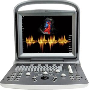 Ecógrafo Portátil Doppler Color ECO6 VET CHISON